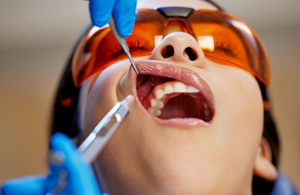 Close-up of patient receiving muscle relaxant treatment for jaw clenching during dental procedure.